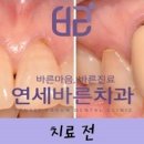 연세바른치과 이미지