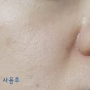 엠디케어 | 일리윤엠디 레드이치 케어크림 - 건조함까지 한번에 싹 관리하는 가려움크림