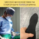 하부골 이미지