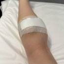 편한마디통증클리닉 | 압구정로데오역 유라인클리닉 지방분해주사 종아리컷주사 3회차 후기