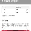 스마일 | 스마일라식 후기-1(검사결과)