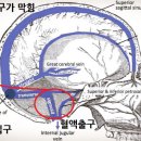 코로나 백신 혈전을 일으키는 이유 이미지