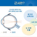 우리눈안경 이미지
