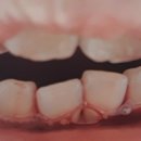 아프지않은행복치과의원 이미지