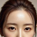 이미지업의원 | PCL 이마 실리프팅 후기, 가격, 부작용, 이마주름제거 시술 과정