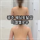 대게샵 점 | 광주웨딩토탈샵 미엘멜로우 붓기빼고 바디관리받은 후기