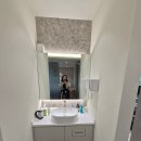 리와인드 | 이마필러 후기 &lt;리와인드성형외과&gt; 자연스러운 볼륨으로 어려보이는 얼굴 완성!