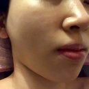 마포피부관리 공덕역 "율뷰티&amp;힐링" : 재생필링 에너지필 후기