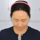 모앤라인성형외과의원 네이버블로그