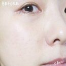 (주)리치바이오 | 아이오페 슈퍼바이탈 크림 바이오 엑설런트 리치 3 주 후기