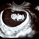 베스트오브미여성의원 이미지