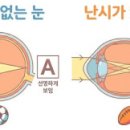 공콘택트렌즈 네이버블로그