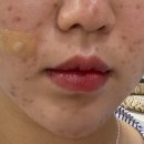 리버스의원 수원점 | 수원시청역 피부과 전문 병원 추천 좋아요 6곳