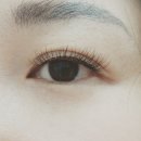안나래쉬