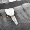 물금센트럴치과의원 이미지