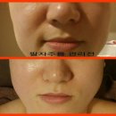 장진희 에스테틱 네이버블로그