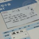 최약국 | 김해 최안과 스마일라식 후기 내돈내산 후회안함 야르~~