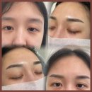 윤메디케어 이미지