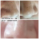 대동의료기 | 마산 얼굴 윤곽 관리 후기｜피지 관리부터 작은얼굴까지 한번에