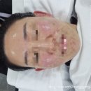 옥포국제시장 | [경남-거제] 거제옥포 피부관리맛집 미백관리 하기좋은 뷰티텐