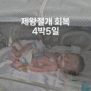 CU복대 나라점 | 제왕절개 회복 1일차~5일차, 강원대학병원 준비물