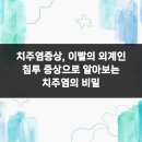 새하양서울치과의원 | 치주염증상, 이빨의 외계인 침투 증상으로 알아보는 치주염의 비밀