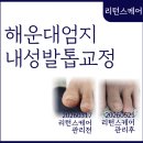리턴스케어 | 해운대 장산 엄지 내성발톱 교정, 두 달 만에 완성 가능