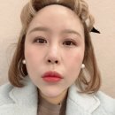 보조개 수술후기 청주보조개