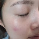 (주)에버셀 | 20대 후반 / 주름관리 / 에버셀 딥 링클 솔루션 크림