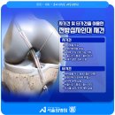 은십자