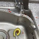 대중병원 | 손가락 신경 수술 후기 (feat. 광주대중병원)