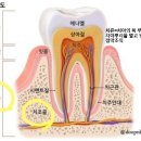 골절(치아파절포함)진단비 특별약관과 상해수술비보장 특별약관의 비교 이미지