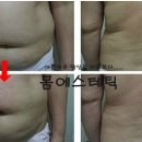 금불테라피 이미지
