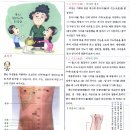 요실금 병원에 약이없어. 침 뜸 지압 이미지