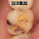 내이치과기공소 이미지