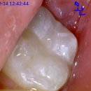 보강치과기공소 이미지