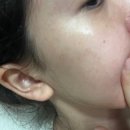 미나성형외과의원 | 민감피부의 구세주, 트랜드미 센스티브칼라미나밸런스토너&amp; 센스티브클리어밸런스크림 2종 사용 후기