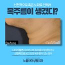 노블와이성형외과의원 이미지
