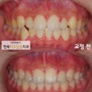 연세미소담은치과 이미지
