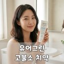 고불소치약 시린이치약 고민된다면, 직접 써본 유어그린 센시가드 치약 후기