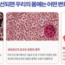 성경의료기 네이버블로그