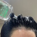 더 힐링스 | 탈모트리트먼트 추천 모에타더뉴힐링스 머리빠짐 적어진 솔직후기