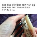 마녀손톱 이미지