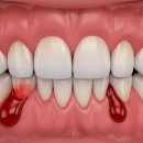 뉴플란트치과의원 이미지