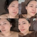 첨단라인2차 | AI 진단하고 케어받는 첨단 웨딩관리, 백화에스테틱