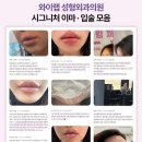 와이랩성형외과의원 네이버블로그