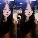 [대구] 부분절개 쌍커풀수술 1년후기 (눈매교정+매직앞트임) [쌍액 10년차]