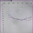 신세계보청기 이미지