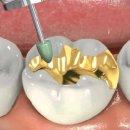 센트럴치과기공소 이미지