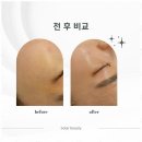 솔라뷰티